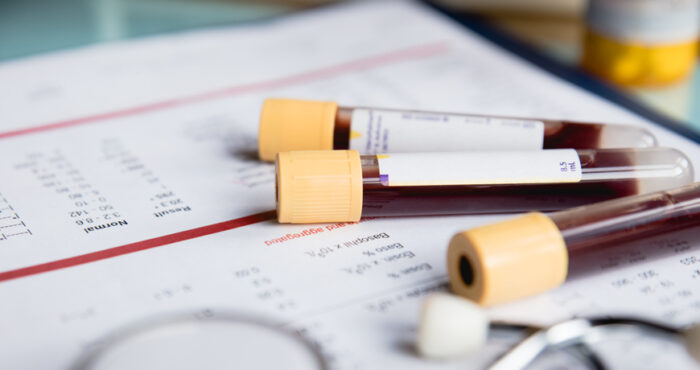 Blood donation stock photo