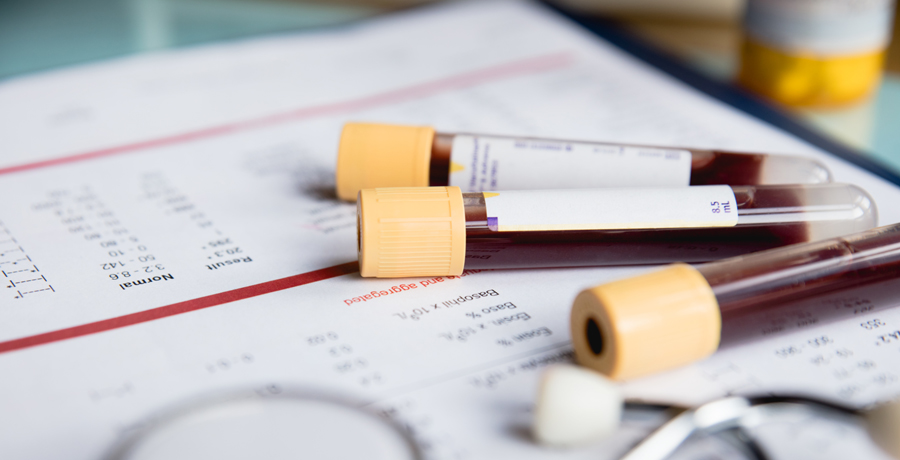 Blood donation stock photo