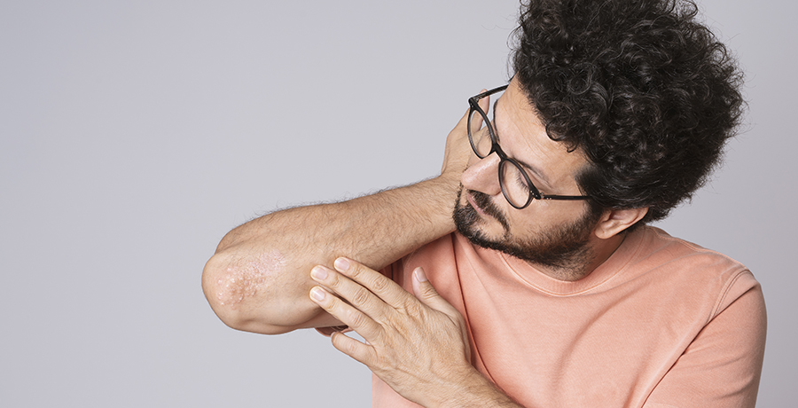 Man looking at skin rash on arm